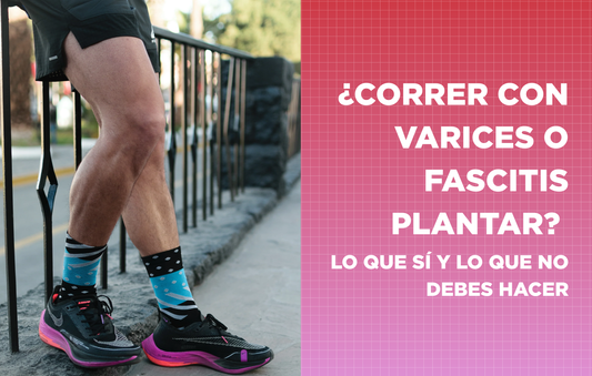 ¿Correr con varices o fascitis plantar? Lo que sí y lo que no debes hacer